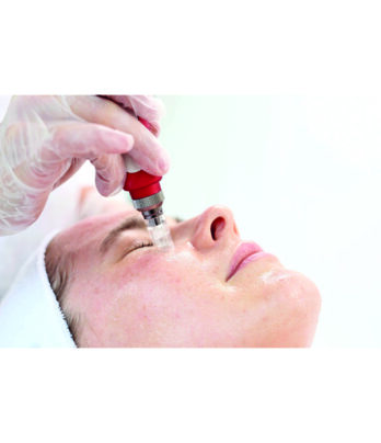 Micro Needling